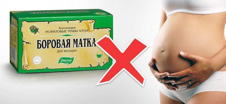 Миома матки