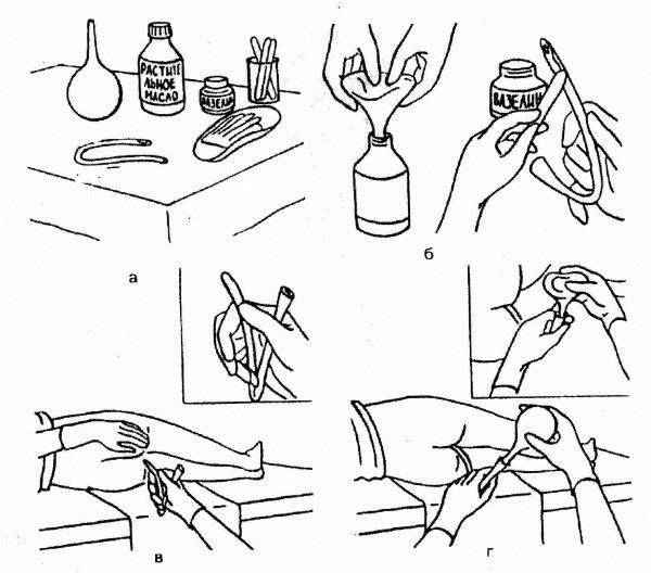 Подготовка к колоноскопии клизмой - если процедура утром и при помощи касторки