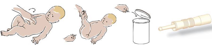 Как сделать клизму новорожденному ребенку в домашних условиях: видео