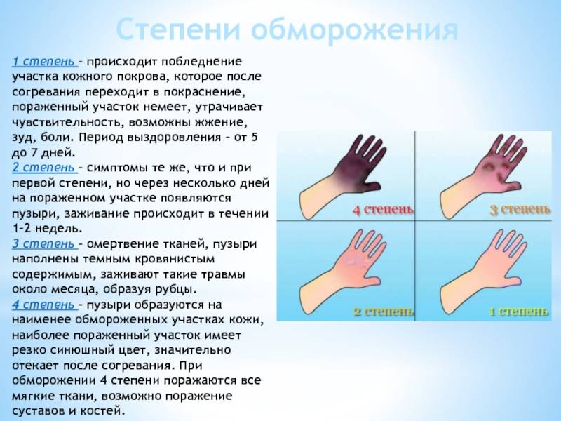 Онемение пальцев рук и ног.  к какому врачу обращаться при онемении конечностей
