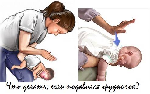 Диспраксия у детей: что это такое | семейный доктор