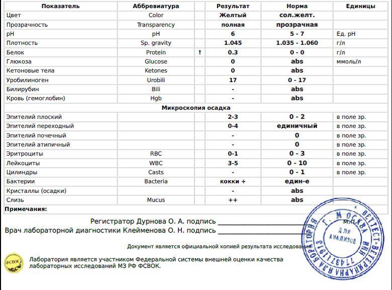Уробилиноген в моче