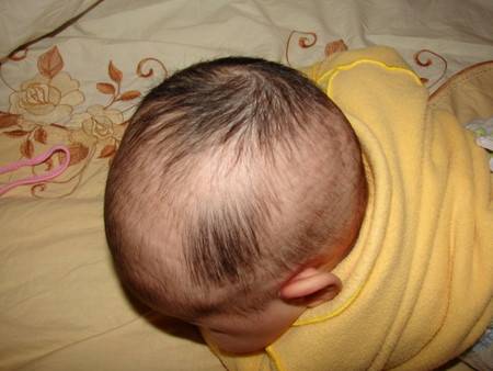 Почему у ребенка плохо растут волосы? | мамоведия - о здоровье и развитии ребенка