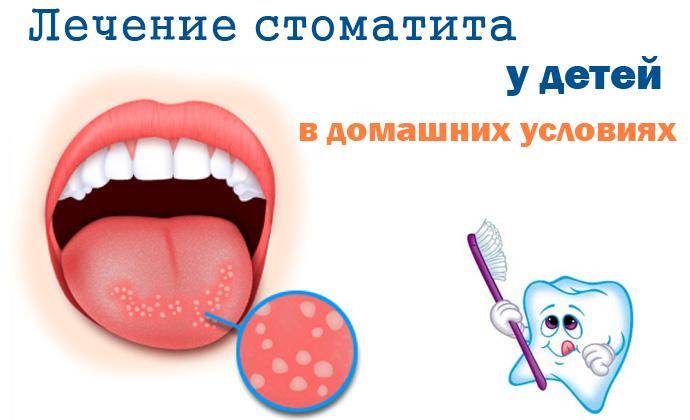 Воспаление половых губ (вульвит) - симптомы и лечение. рекомендации гинеколога