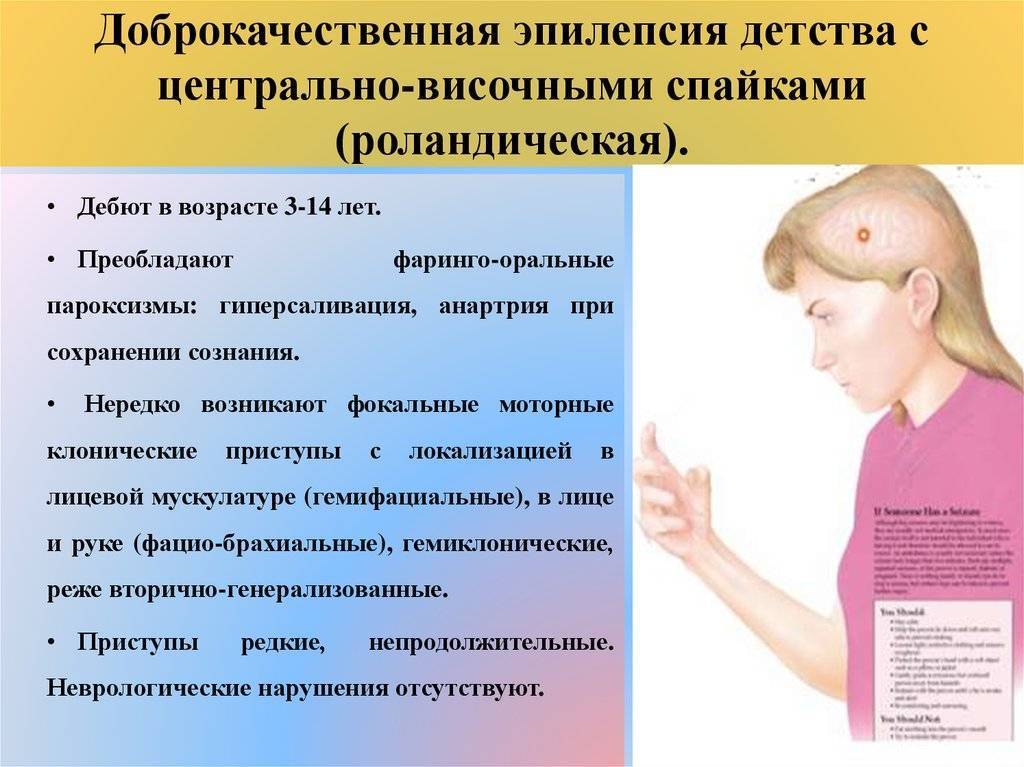 Эпилепсия у детей - лечение в лучших клиниках россии