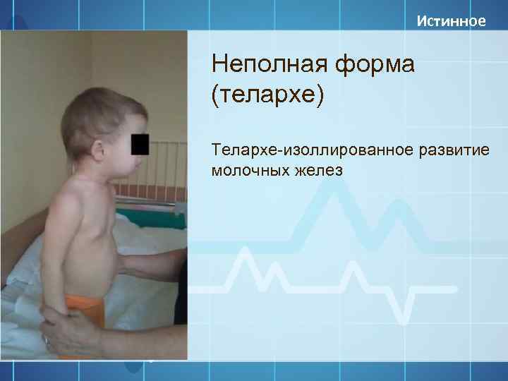 Телархе в 5 лет | все вопросы и ответы о "телархе в 5 лет" | 03.ru - скорая помощь онлайн