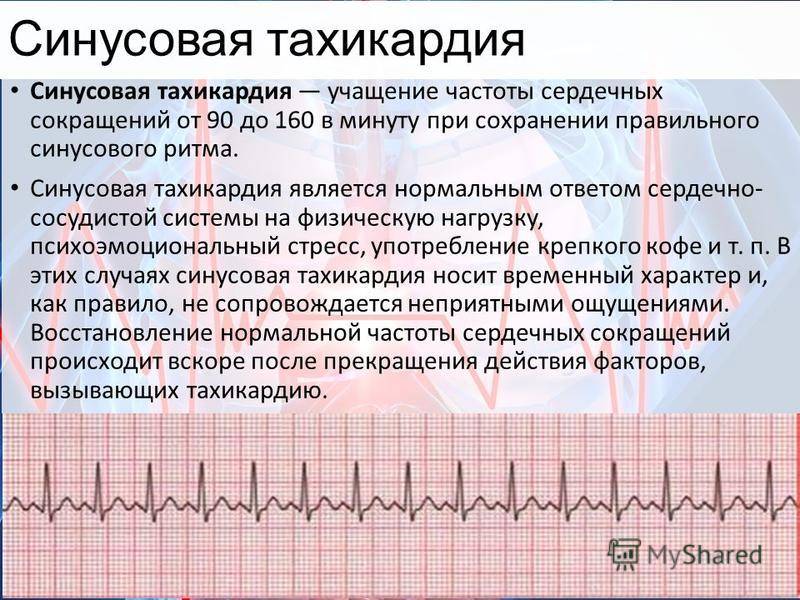Нарушение ритма сердца, причины и лечение нарушения ритма сердца с диагностикой в центре