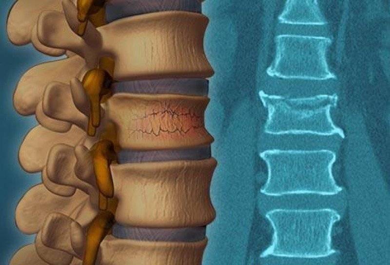Укол блокада от боли в спине в москве в клинике дикуля: цены, запись на прием | центр дикуля