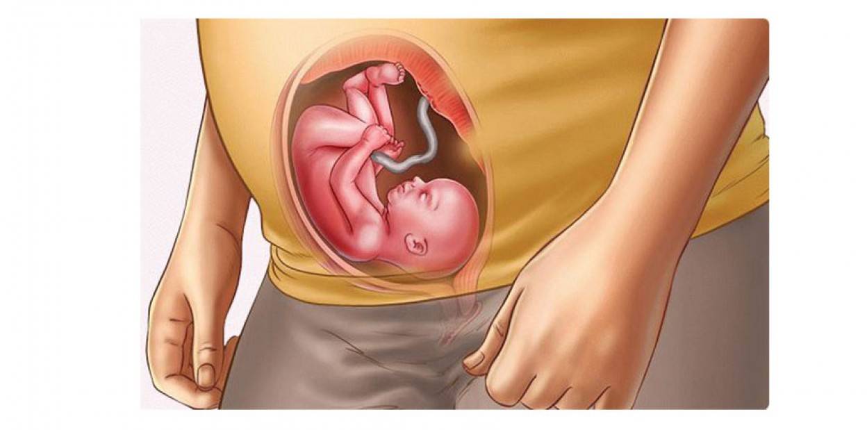 Pinchazos embarazo tercer trimestre