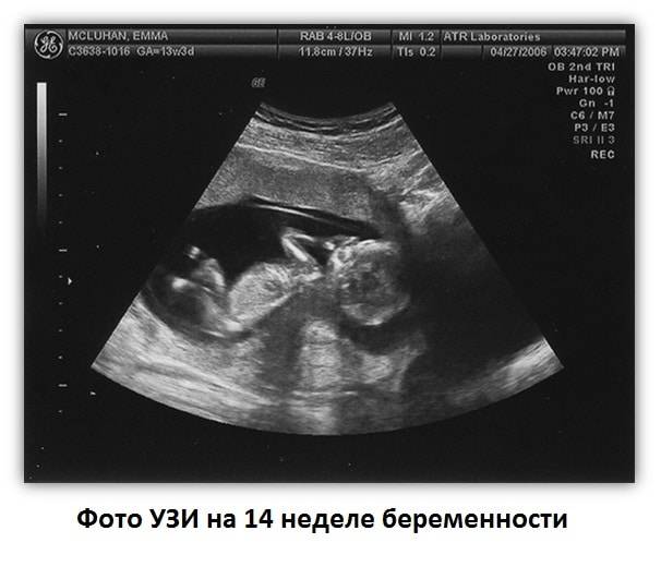 14 неделя беременности от зачатия