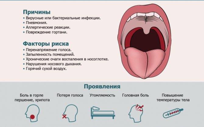 Хронический тонзиллит