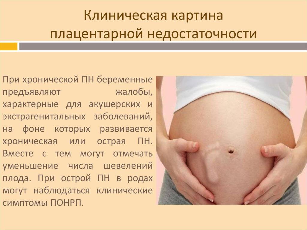 Невынашивание беременности