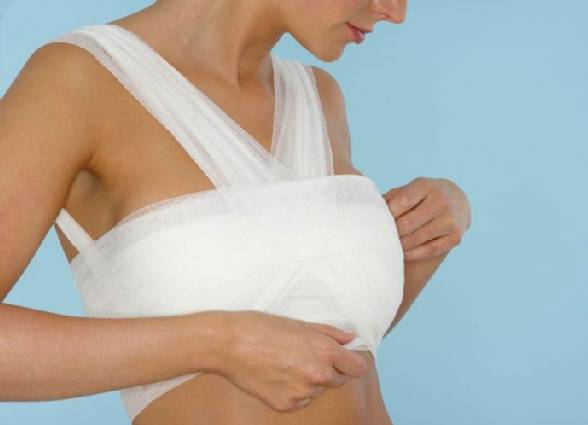 Как правильно перевязать грудь для завершения лактации