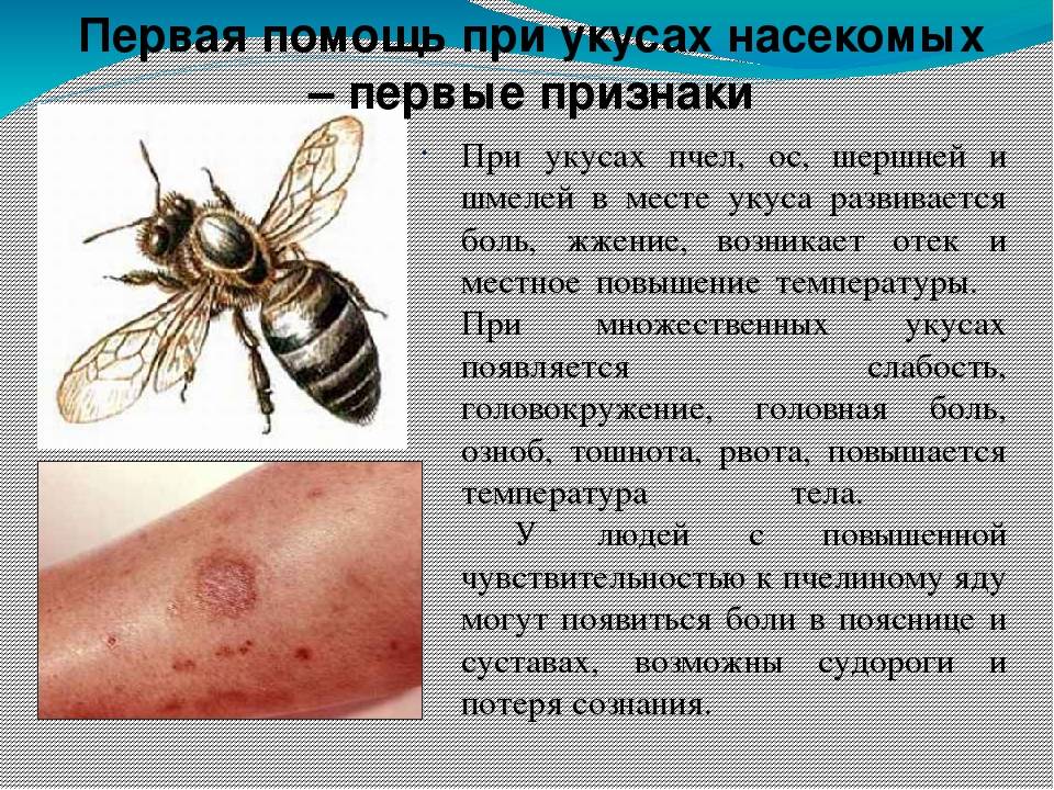Что делать, если ребенка покусали комары, мошки, осы или пчелы?