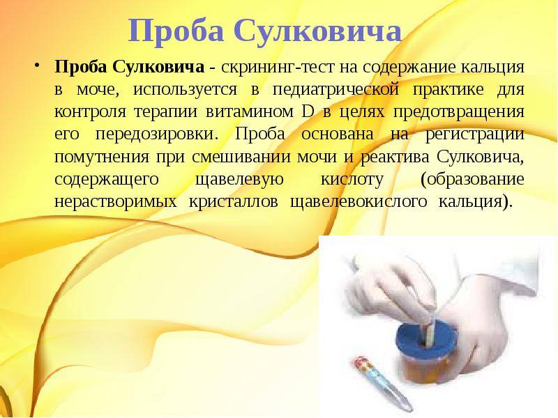 Химико-токсикологический анализ мочи (хти) в спб.