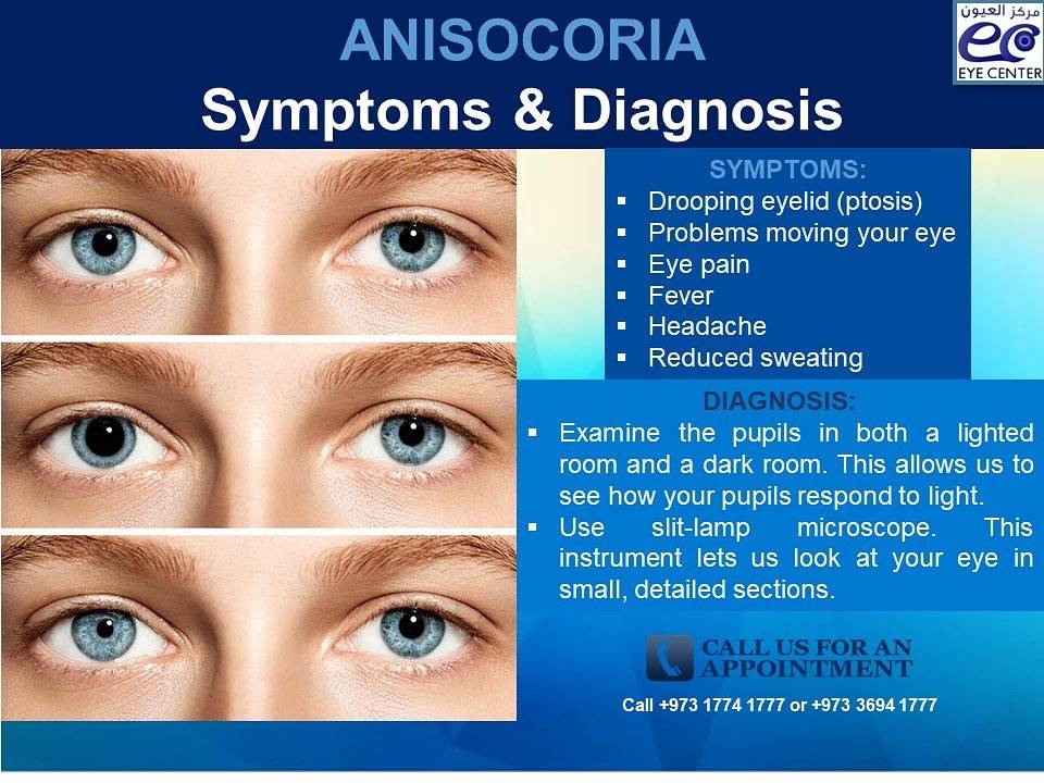 Кератоконус глаза - лечение, симптомы, признаки, причины и стадии заболевания