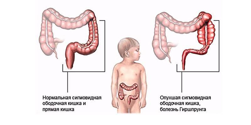 Детский гастроэнтеролог — консультация и прием. причины обращения к детскому гастроэнтерологу.