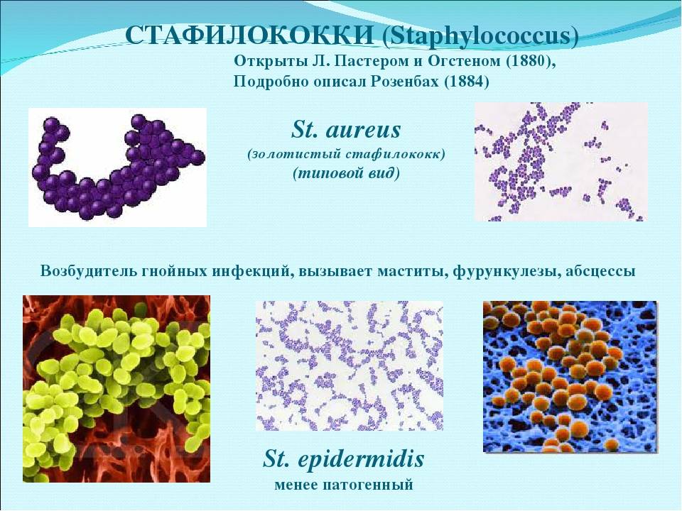 Staphylococcus aureus степени. Стафилококки коагулазоположительные s. aureus. Стафилококк ауреус микробиология. Стафилококк ауреус золотистый. Бактерия стафилококк Тип питания.