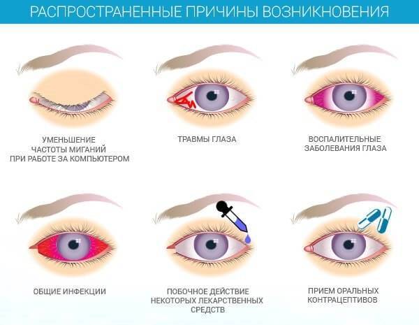 Как проводится обработка глаз при конъюнктивите?