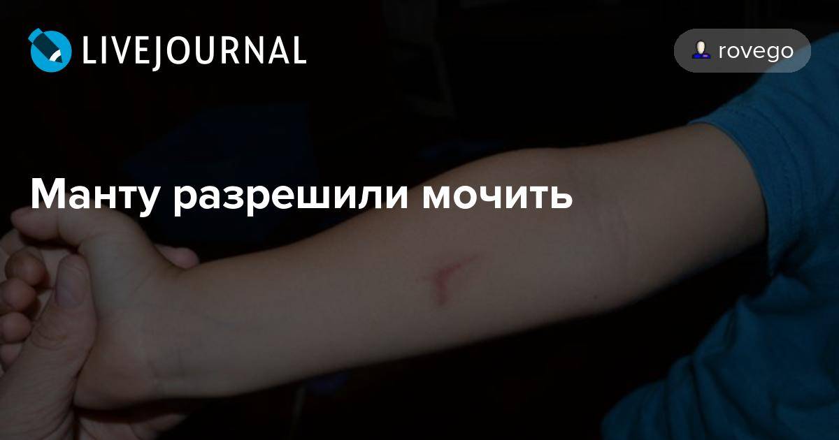 Диаскинтест мочить. Почему нельзя мочить манту. Сколько нельзя мочить диаскинтест. Дискрин тест сколько нельзя мочить.