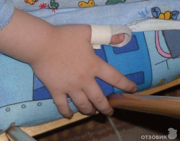 Причины и последствия сосания большого пальца взрослым человеком - medical insider
