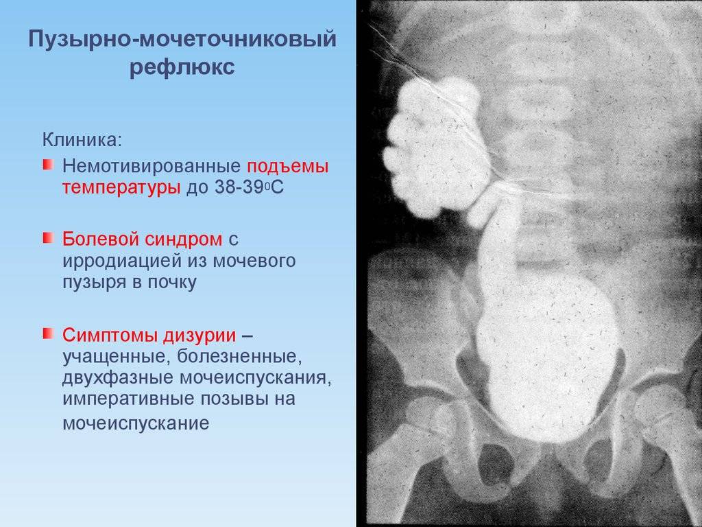 Детские государственные урологические клиники в москве