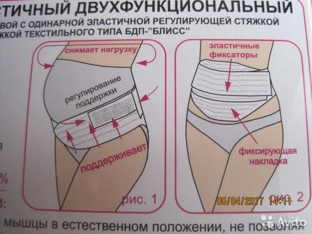Как убрать послеродовой живот после кесарева в домашних условиях, упражнения для послеродовых растяжек | доктор борменталь