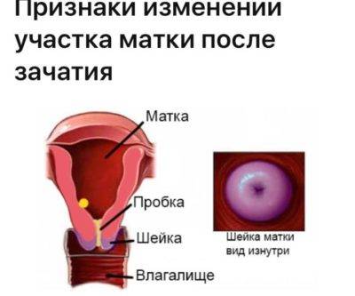 Шейка матки перед месячными и при беременности