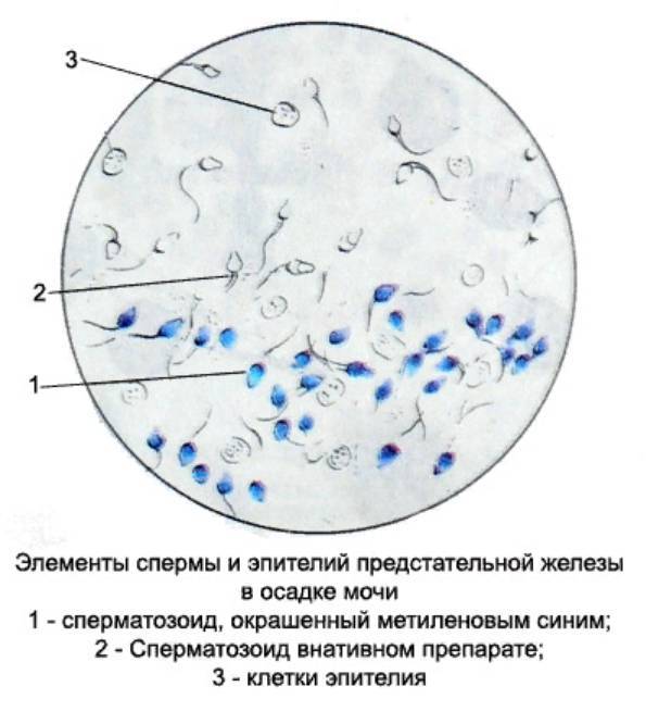 Лецитиновые зерна в спермограмме