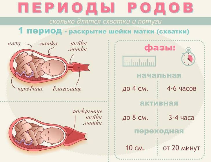 Роды после снятия акушерского пессария: через сколько начинаются схватки и когда можно родить?