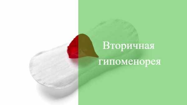 Скудные месячные - мнение эксперта