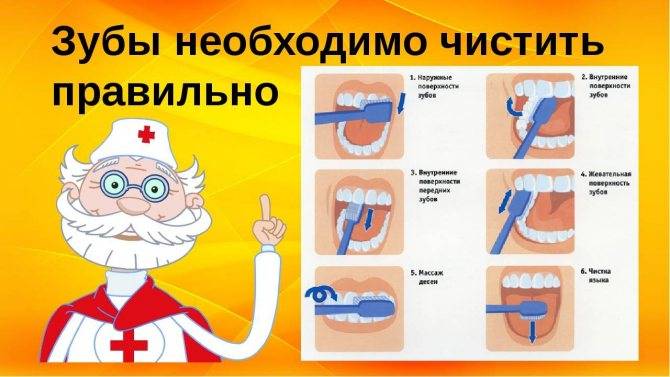 Как делают профессиональную чистку зубов?