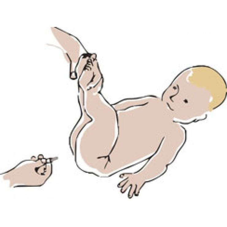 Клизма новорожденному при запоре - как делать, как ставить, видео
