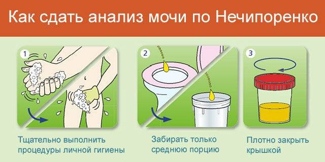 Моча по зимницкому у детей | детские анализы в медицинской лаборатории эндомедлаб  (г. москва, м. дмитровское, м. борисово)